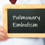 Pulmonary Emboli